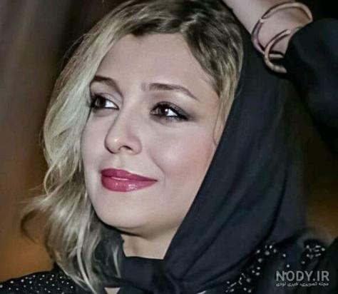 ساره بیات قبل عمل
