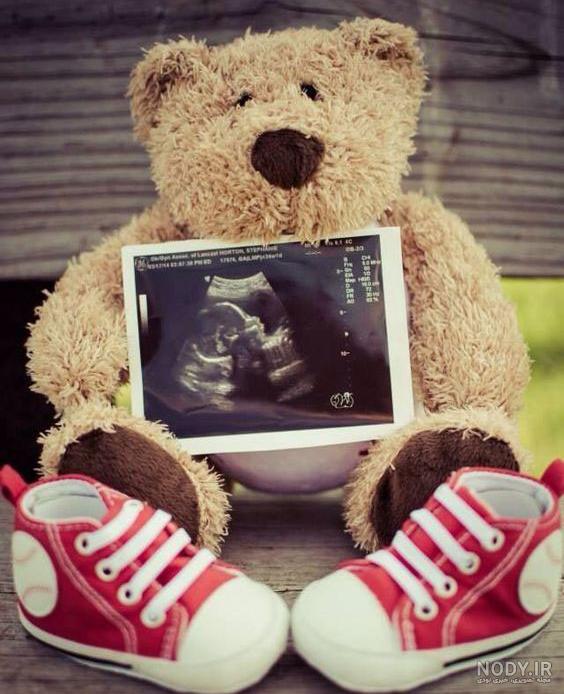 عکس سونوگرافی جنین پسر ۱۴ هفته
