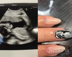 عکس سونوگرافی جنین پسر ۱۴ هفته