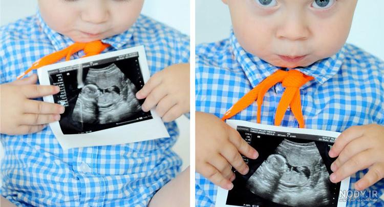 عکس خفن عکس سونوگرافی برای پروفایل