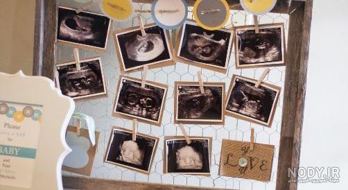 عکس سونوگرافی جنین پسر ۱۴ هفته