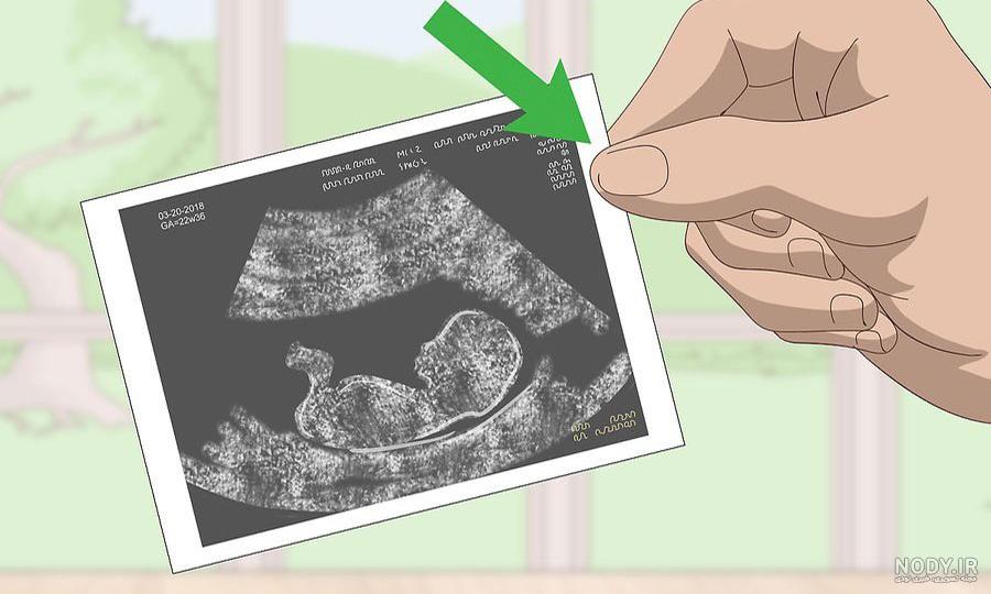 عکس سونوگرافی جنین پسر ۱۴ هفته