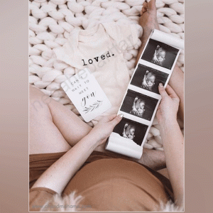 عکس خفن عکس سونوگرافی برای پروفایل