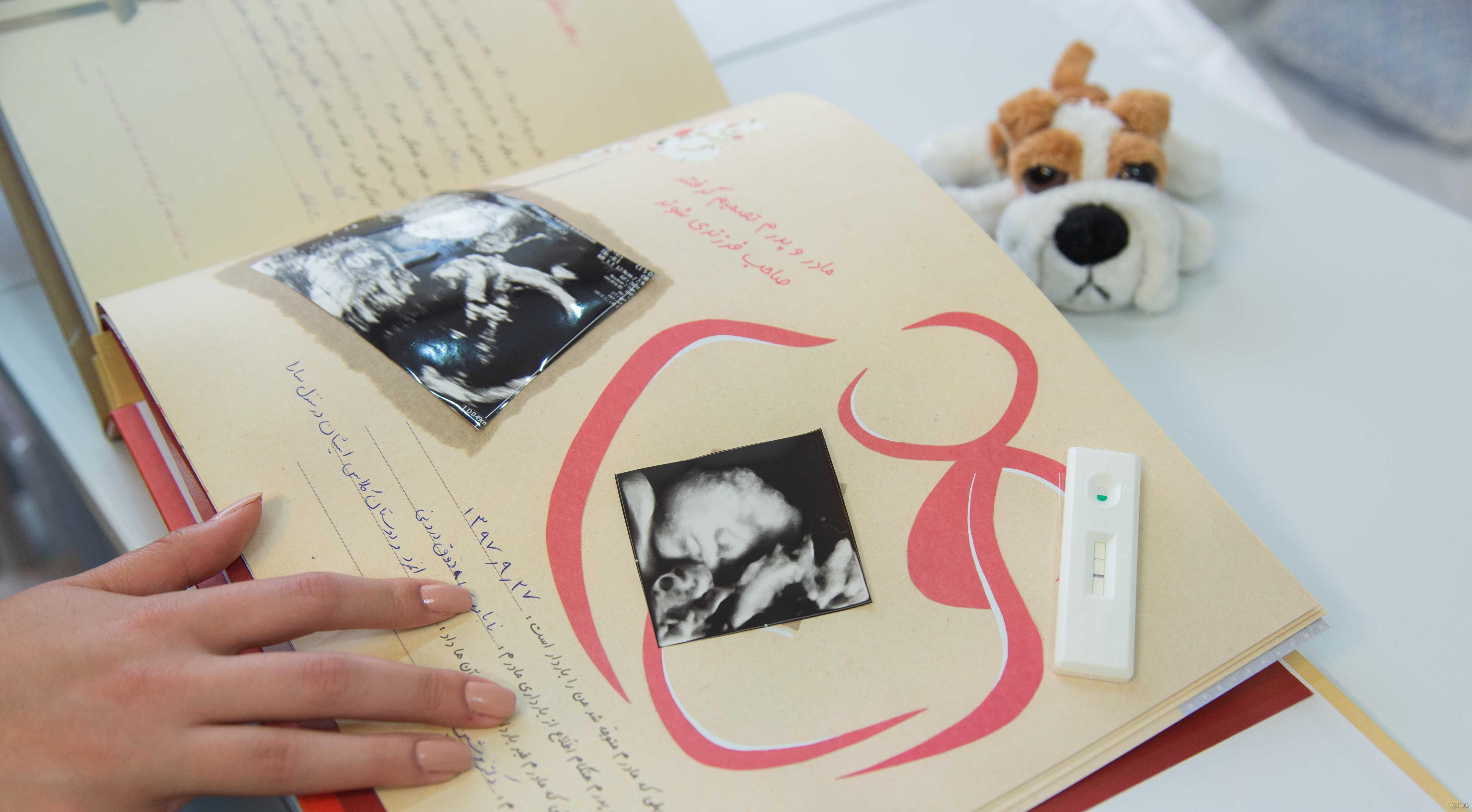 عکس سونوگرافی جنین پسر ۱۴ هفته