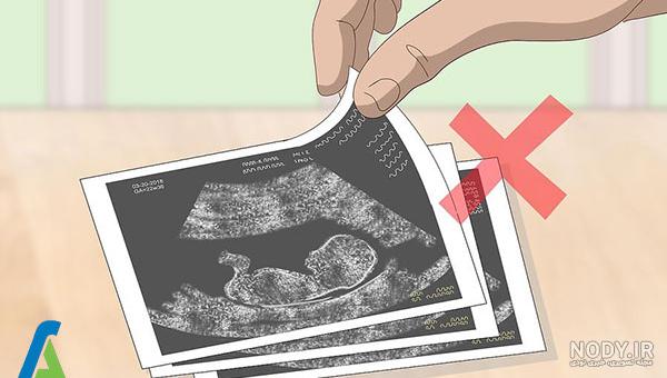 عکس خفن عکس سونوگرافی برای پروفایل