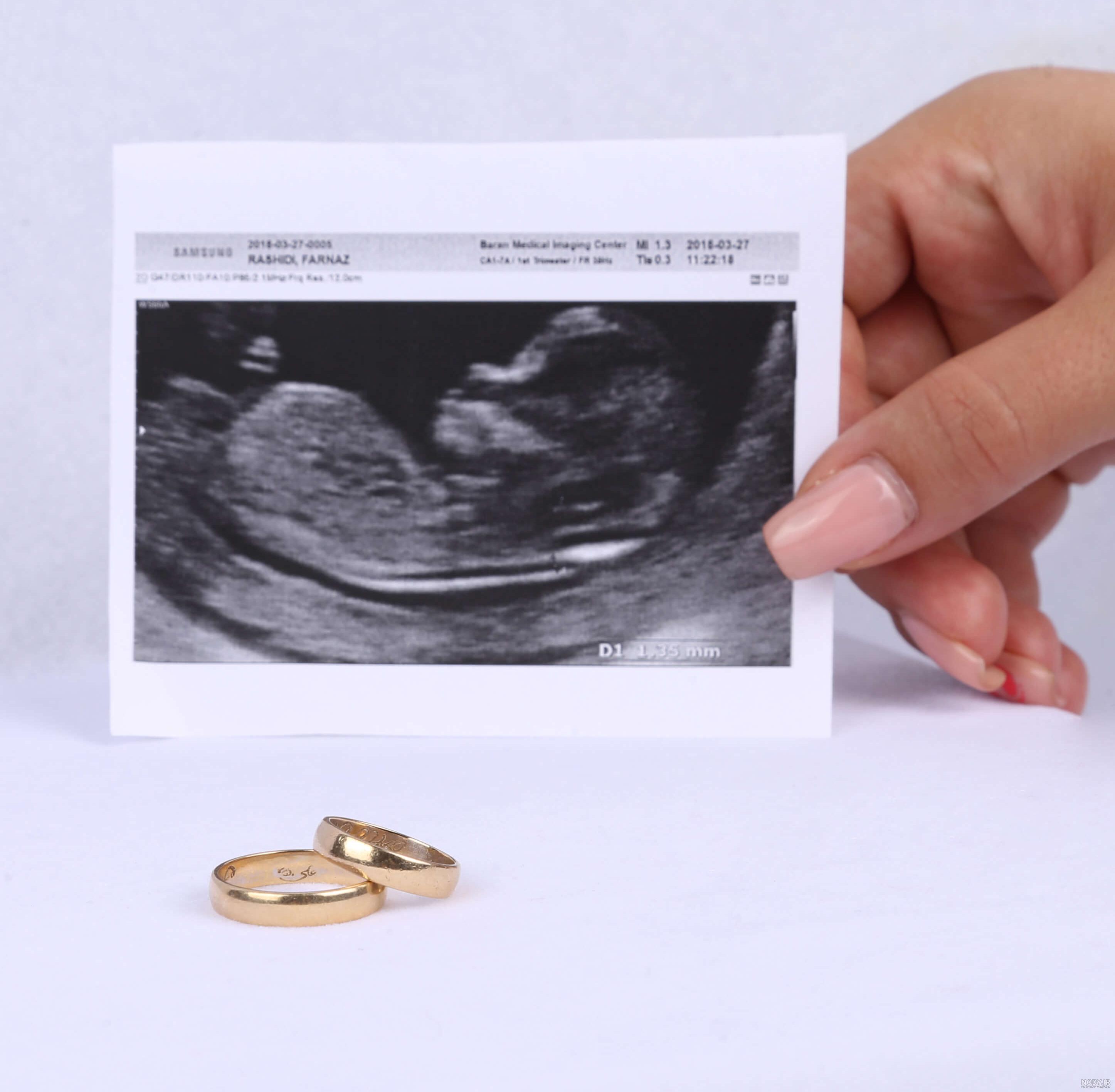 عکس خفن عکس سونوگرافی برای پروفایل