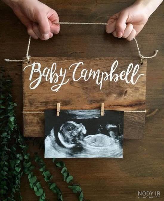 عکس سونوگرافی جنین پسر ۱۴ هفته