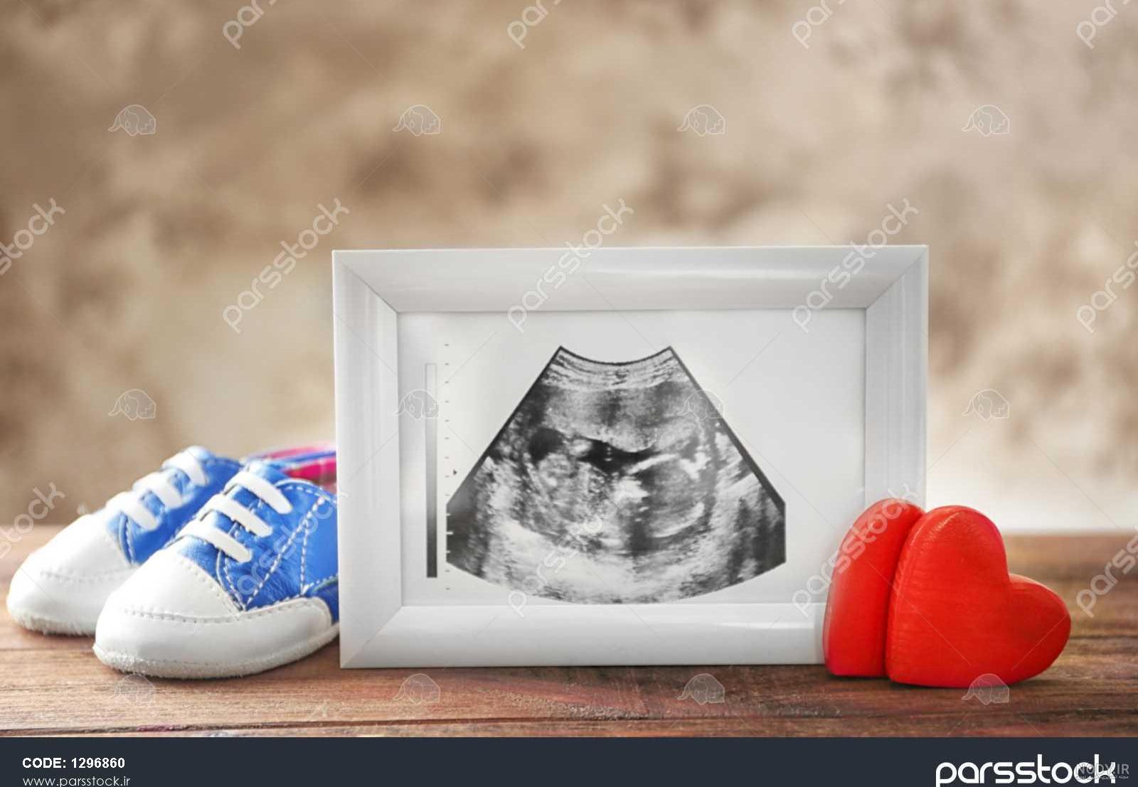عکس سونوگرافی جنین پسر ۱۴ هفته