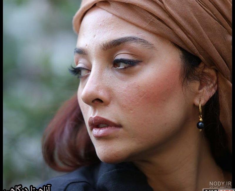 آناهیتا درگاهی در سریال می خواهم زنده بمانم