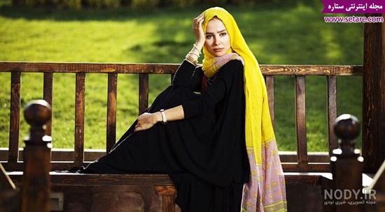 الناز حبیبی قبل از عمل