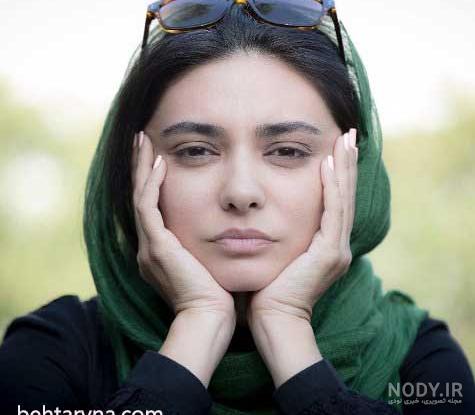 الناز حبیبی قبل از عمل