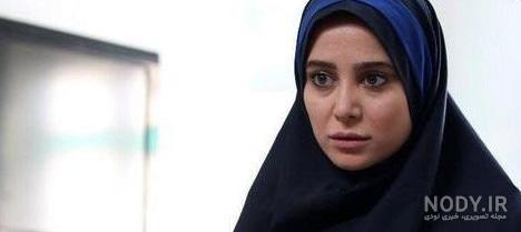 الناز حبیبی قبل از عمل بینی