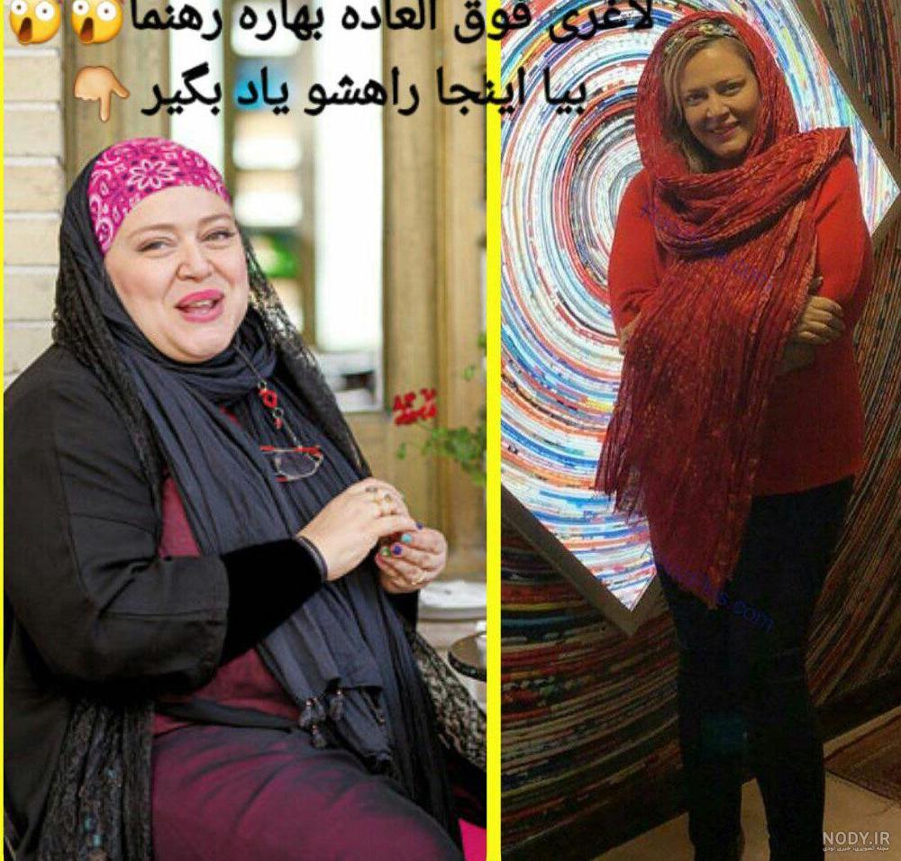 دانلود عکس بهاره افشاری قبل از عمل دانلود عکس بهاره افشاری قبل از عمل