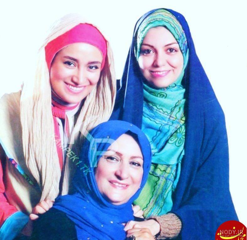 عکس بهاره افشاری قبل و بعد از عمل عکس بهاره افشاری قبل و بعد از عمل