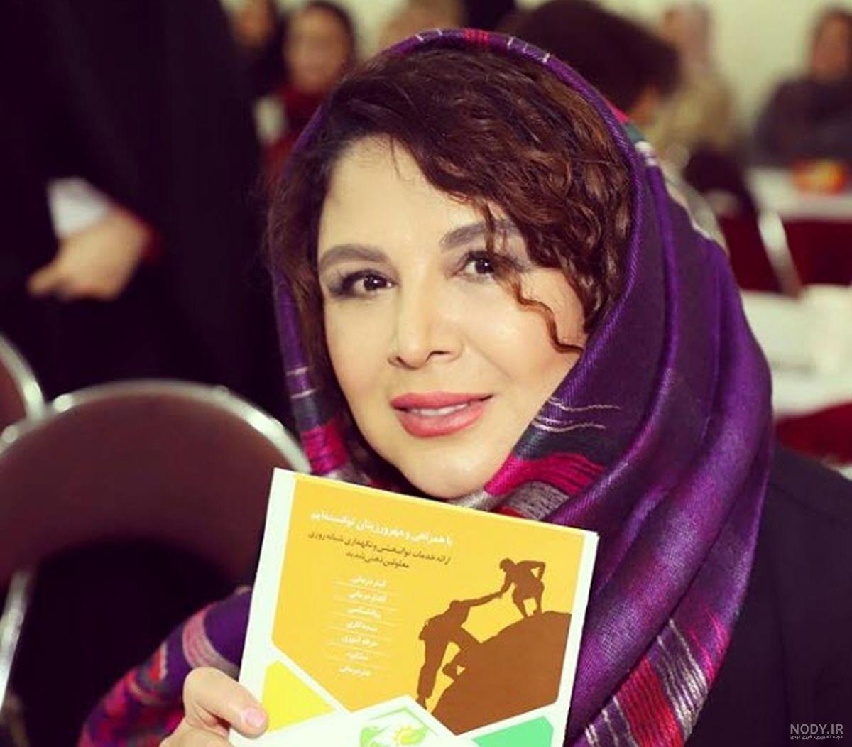 بیماری شهره سلطانی بیماری شهره سلطانی