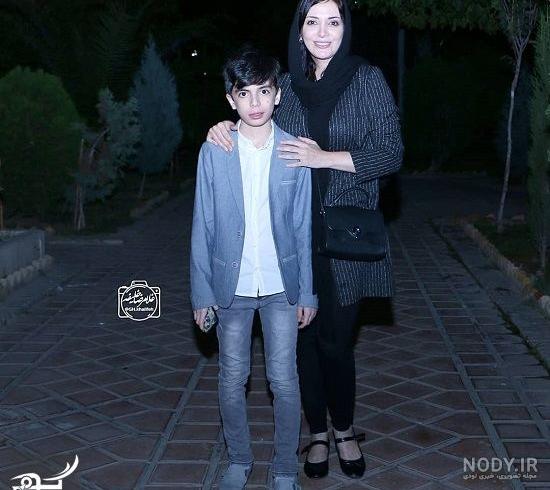 رویا میرعلمی قبل از عمل زیبایی