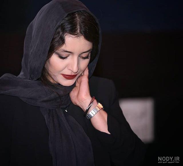 ساره بیات قبل عمل