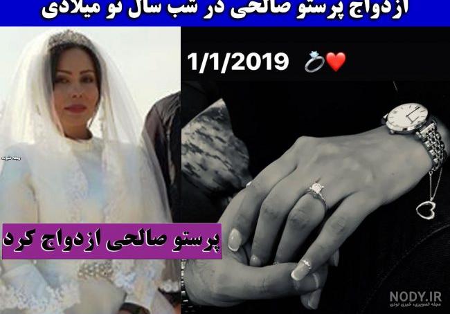 عکس بازیگران ترکیه قبل و بعد از عمل زیبایی عکس بازیگران ترکیه قبل و بعد از عمل زیبایی