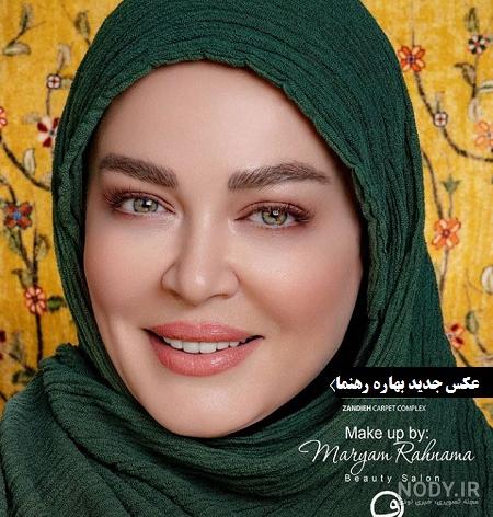 بهاره رهنما بعد از عمل زیبایی