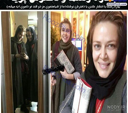 بهاره رهنما قبل و بعد عمل بینی
