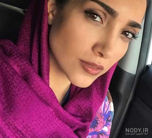 خاطره اسدی قبل از عمل