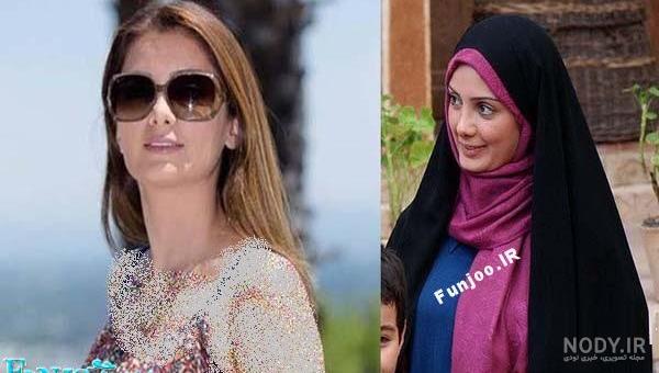 سمیرا سیاح قبل از عمل بینی سمیرا سیاح قبل از عمل بینی