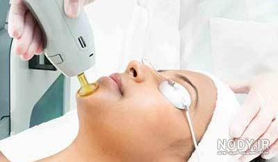 عکس از لیزر موهای زائد عکس از لیزر موهای زائد