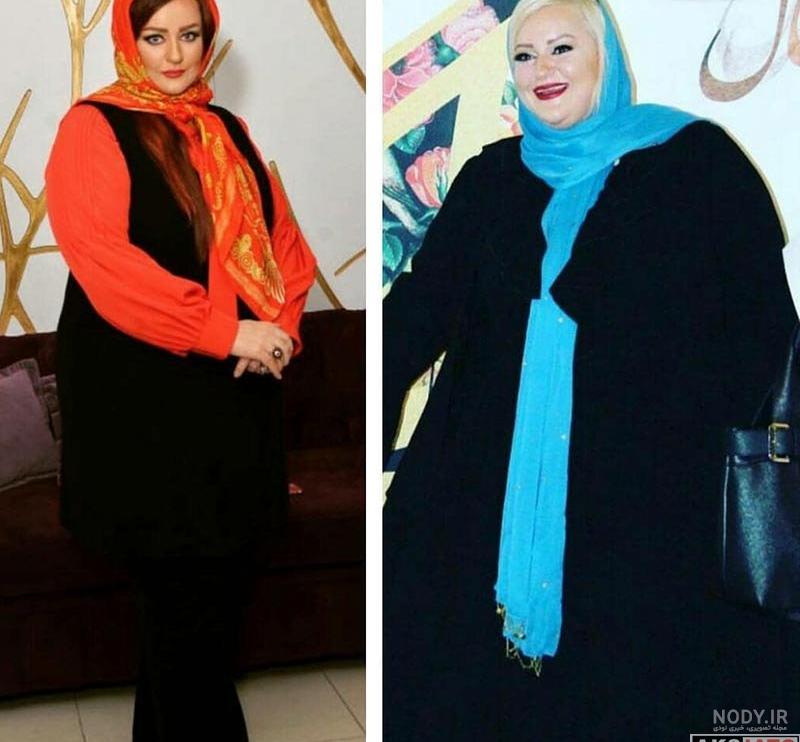 مادر بهاره رهنما بعد از عمل