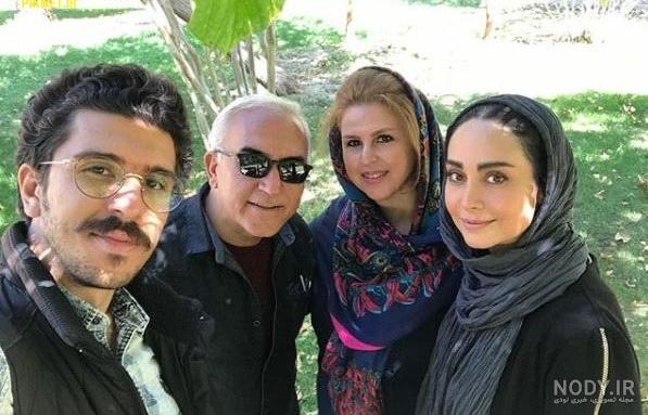 مینا نوروزی قبل از عمل بینی مینا نوروزی قبل از عمل بینی