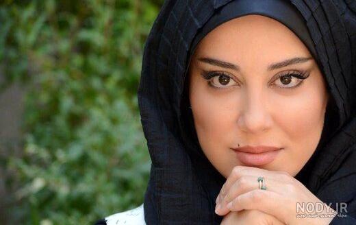 آشا محرابی قبل و بعد عمل