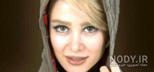 الناز حبیبی قبل از عمل