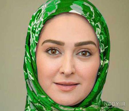 الهام حمیدی قبل از عمل الهام حمیدی قبل از عمل