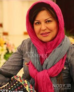 اکرم محمدی بعد عمل