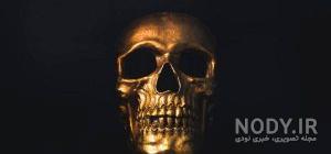 حمله زامبی زامبی واقعی