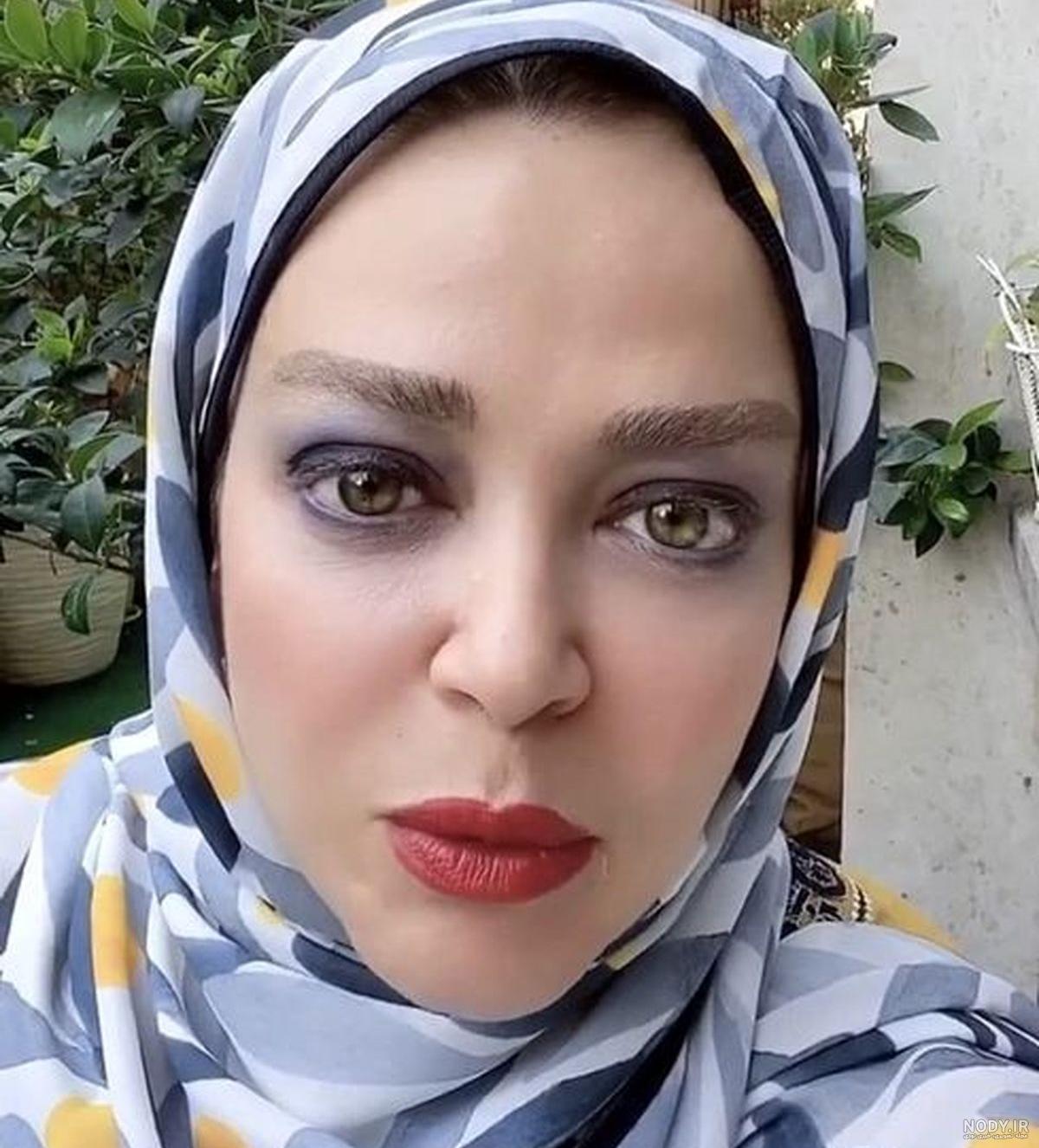 دکتر زینلی جراح بینی نیوشا ضیغمی دکتر زینلی جراح بینی نیوشا ضیغمی