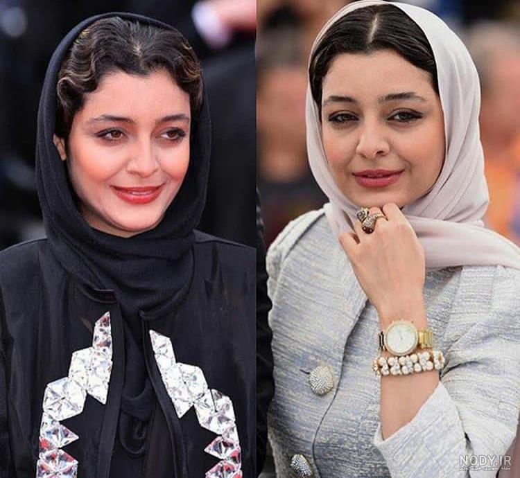 ساره بیات قبل عمل ساره بیات قبل عمل