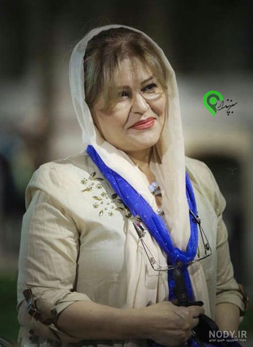 عمل زیبایی اکرم محمدی