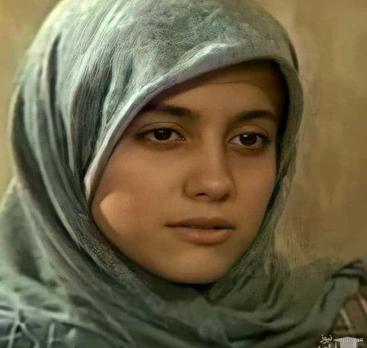 عکس آشا محرابی قبل از عمل بینی