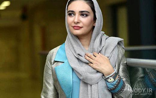 عکس الناز حبیبی قبل از عمل عکس الناز حبیبی قبل از عمل