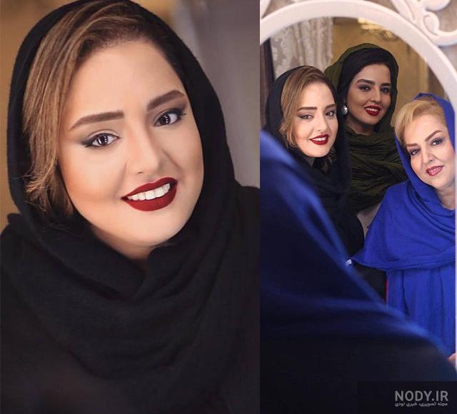 عکس اکرم محمدی بعد از عمل زیبایی