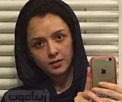 عکس ترانه علیدوستی قبل از عمل زیبایی