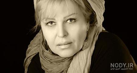 کسانی که با عمل زیبایی زیبا شدند