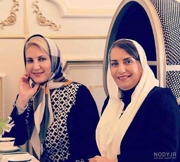 افسانه بایگان قبل از عمل دماغ افسانه بایگان قبل از عمل دماغ