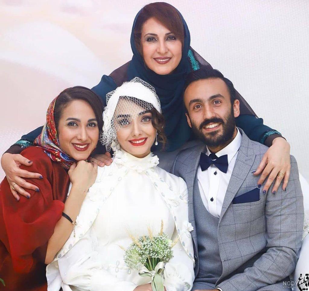 جراحی بینی فاطمه گودرزی جراحی بینی فاطمه گودرزی