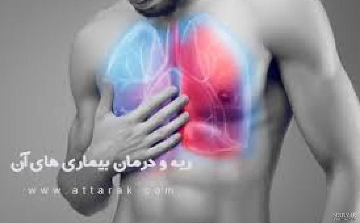درمان گیاهی حساسیت ریه