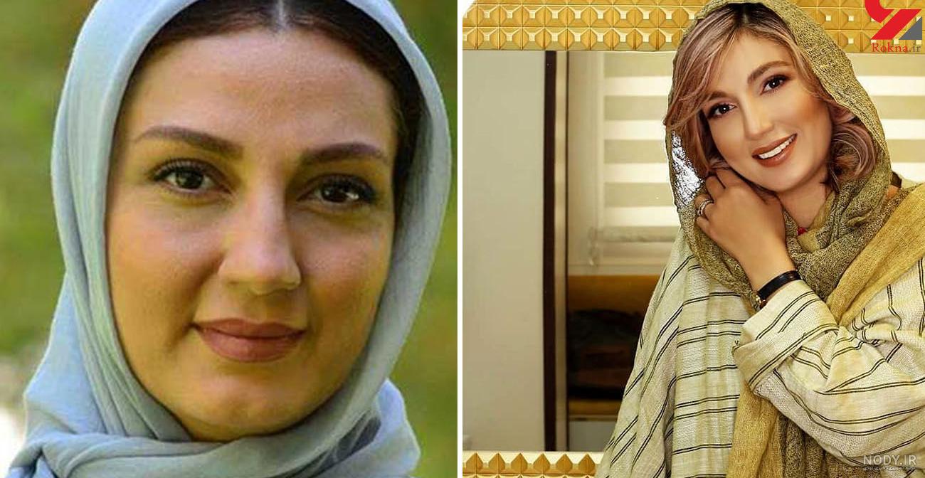 چاق شدن حدیث میر امینی