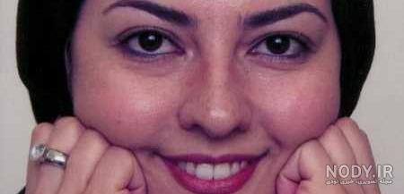 آناهیتا همتی چه بیماری دارد آناهیتا همتی چه بیماری دارد
