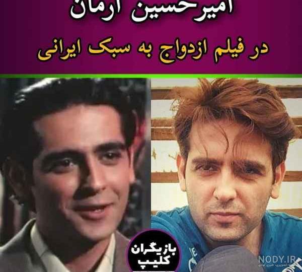 الهه حصاری قبل عمل بینی