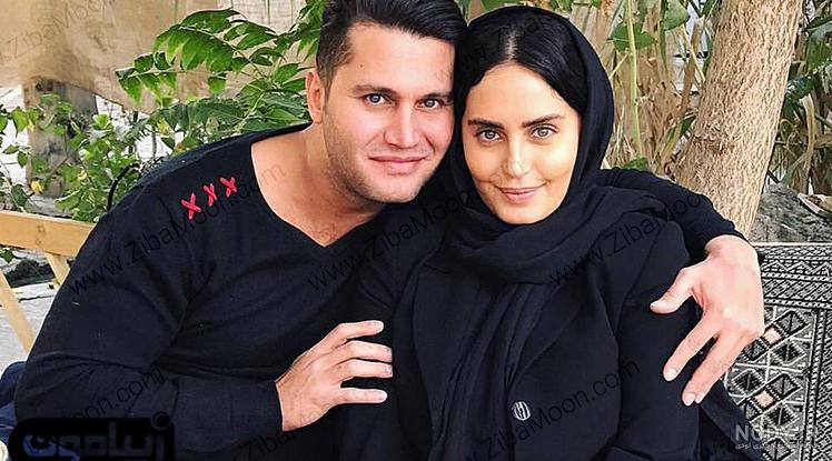 امیر صدهزاری قبل از عمل بینی