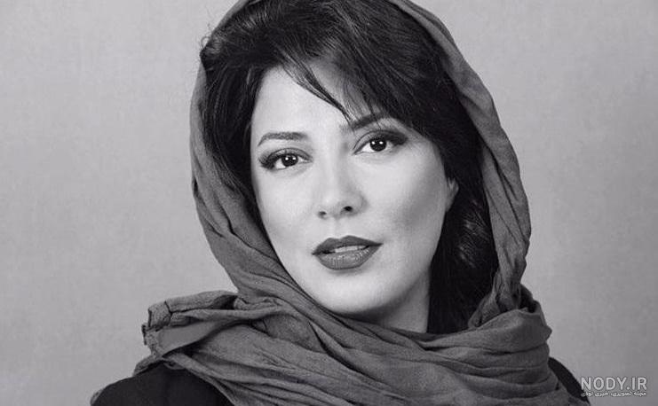طناز طباطبایی قبل از عمل